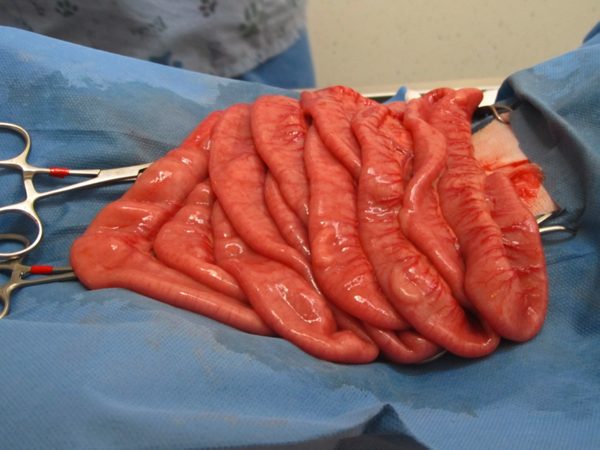 teal-intestine